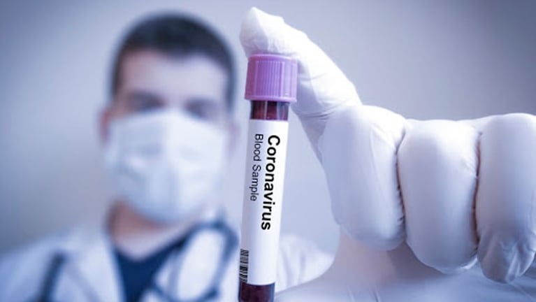 1.184 personas murieron en Argentina por causas relacionadas con el coronavirus.