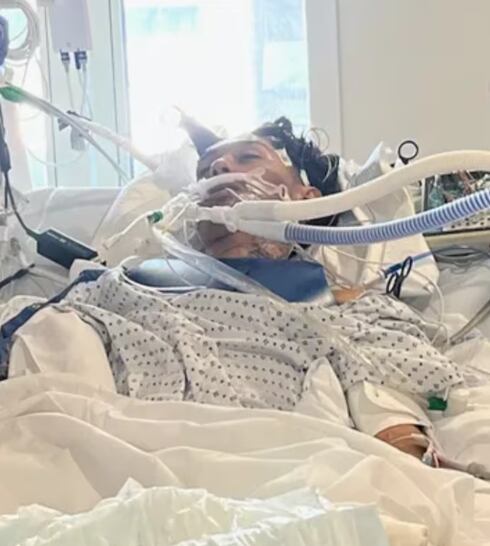 El joven murió tras varios días internado.
