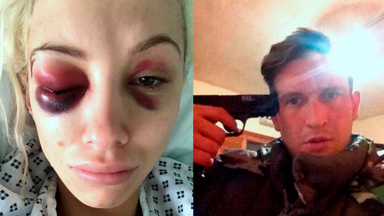 A la izquierda, la joven ya en el hospital. A la derecha su ex pareja. / FOTO: North News.