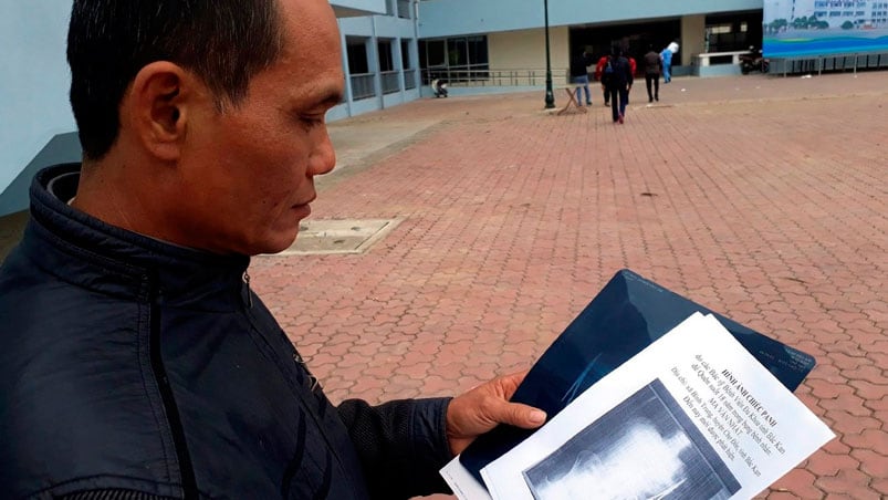 A través de la radiografía descubrieron la tijera.