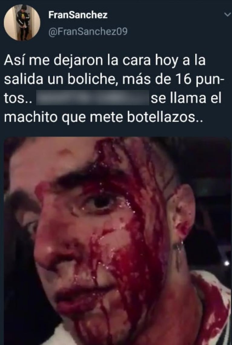 A un joven le abrieron la frente de un botellazo en la Av. Rafael Núñez