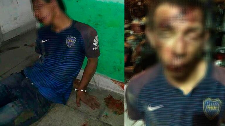 Al supuesto asesino le destrozaron la cara a golpes, en Alderetes, Tucumán.