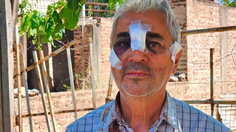 Aldo, el carnicero golpeado por ladrones. Foto: Francisco Arias/ElDoce.