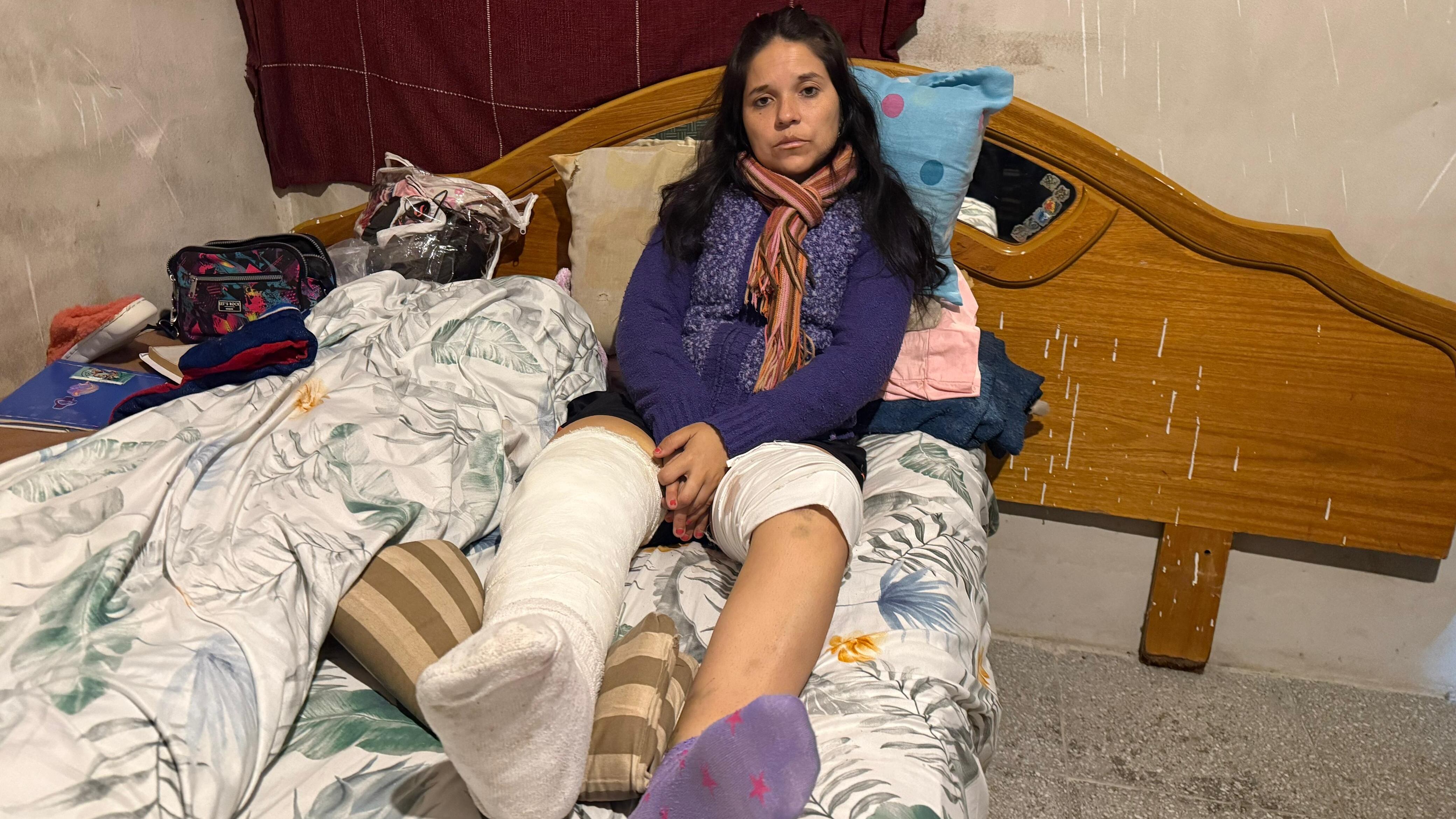 Anabella se recupera de las heridas sufridas en sus piernas. Foto: Luchi Ybañez / ElDoce.