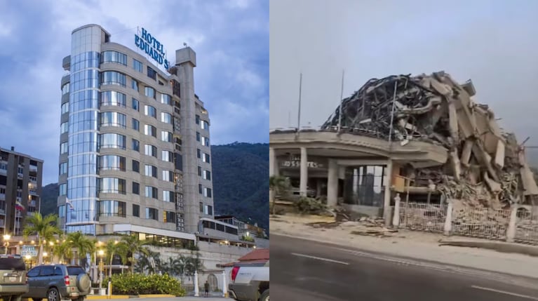 antes y después venezuela