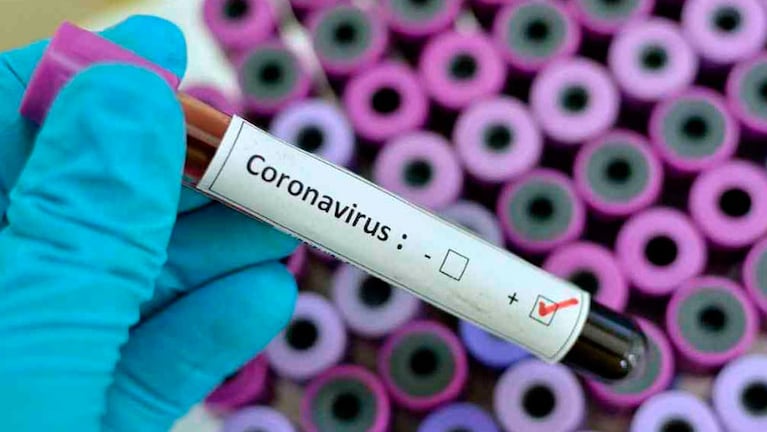Argentina superó los mil casos de coronavirus en un día: en Córdoba hubo un contagio