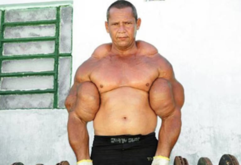 Arlindo de Souza, el Popeye brasileño, murió a los 55 años.