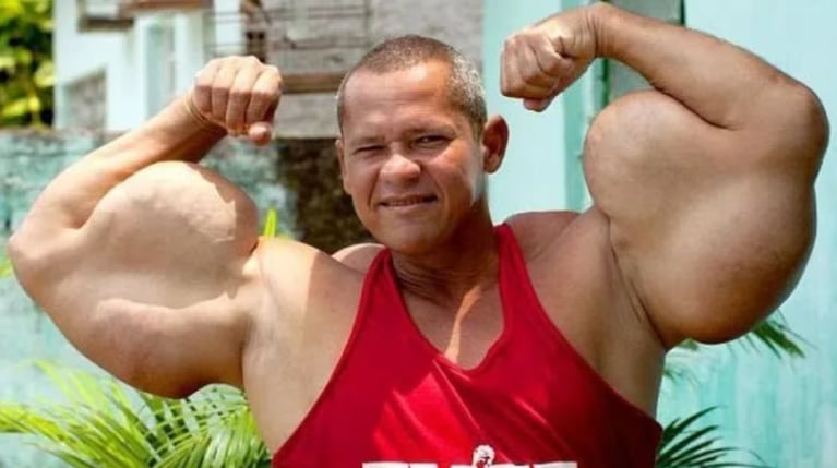 Arlindo de Souza, el Popeye brasileño, murió a los 55 años.