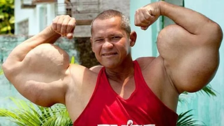 Arlindo de Souza, el Popeye brasileño, murió a los 55 años.