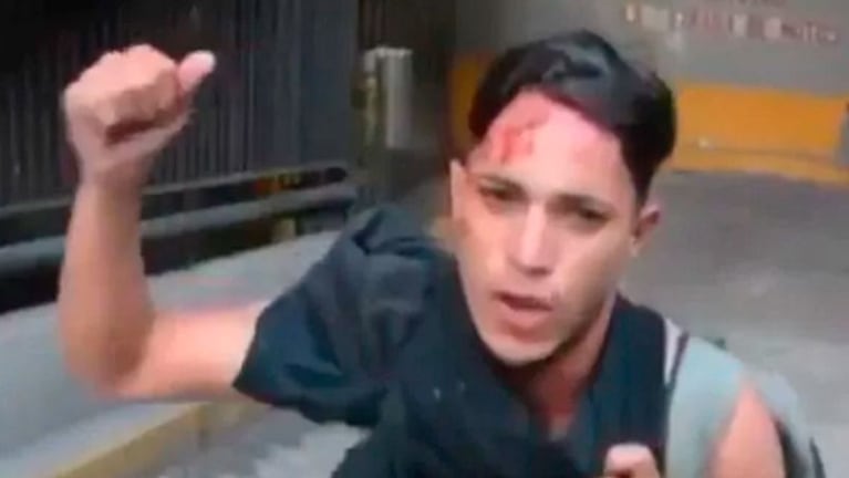 Así apareció el joven herido por el ejército de Maduro.