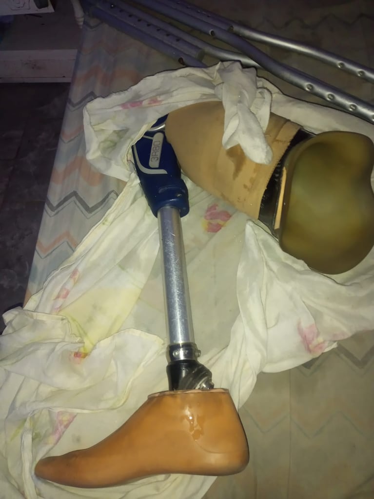 Así le devolvieron la prótesis al vecino de Villa Corina.