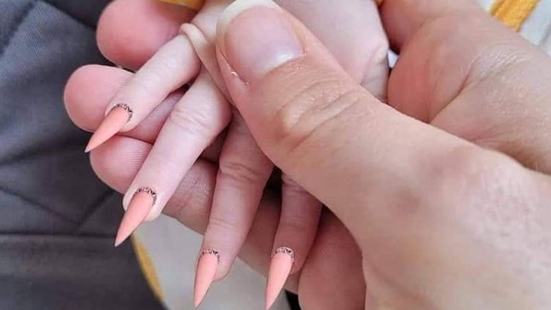 Así le quedaron las uñas a la pequeña. 