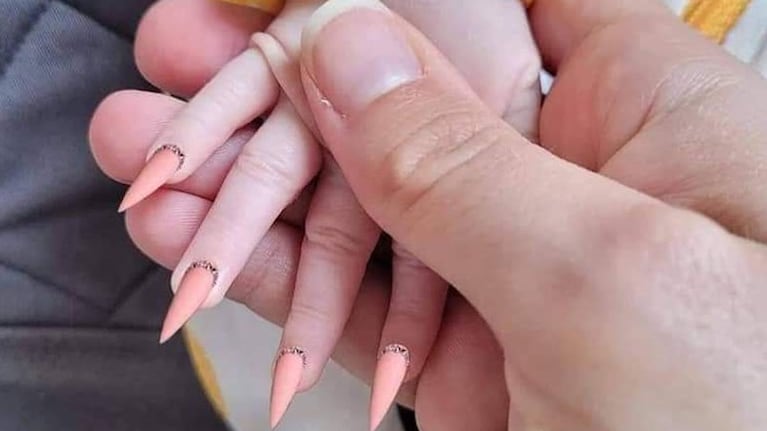 Así le quedaron las uñas a la pequeña.