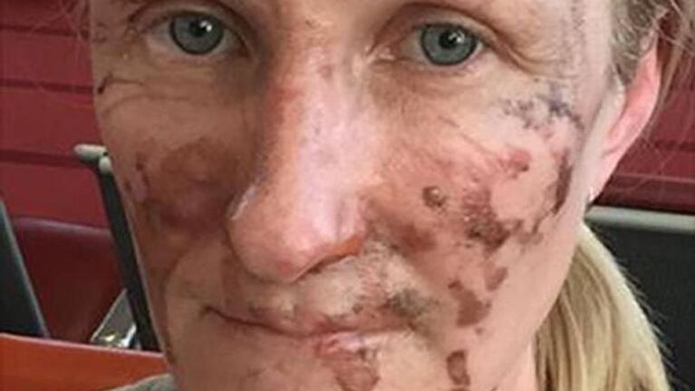 Así le quedó la cara a la mujer británica.