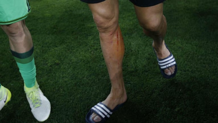 Así le quedó la pierna a Cristiano Ronaldo luego del patadón de Federico Ricca.
