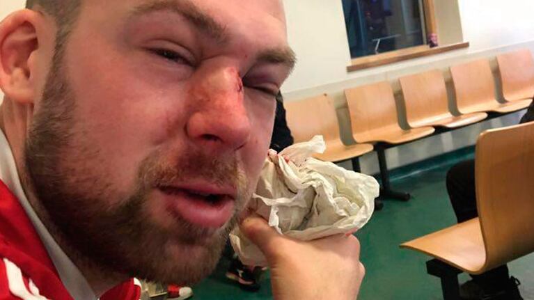 Así quedó Alex Tait después del accidente.