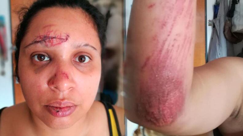 Así quedó Arianna tras el violento robo.