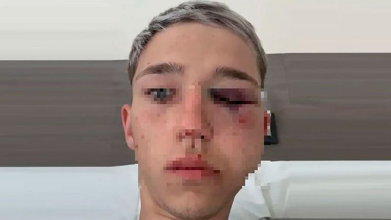 Así quedó el joven golpeado por los rugbiers.