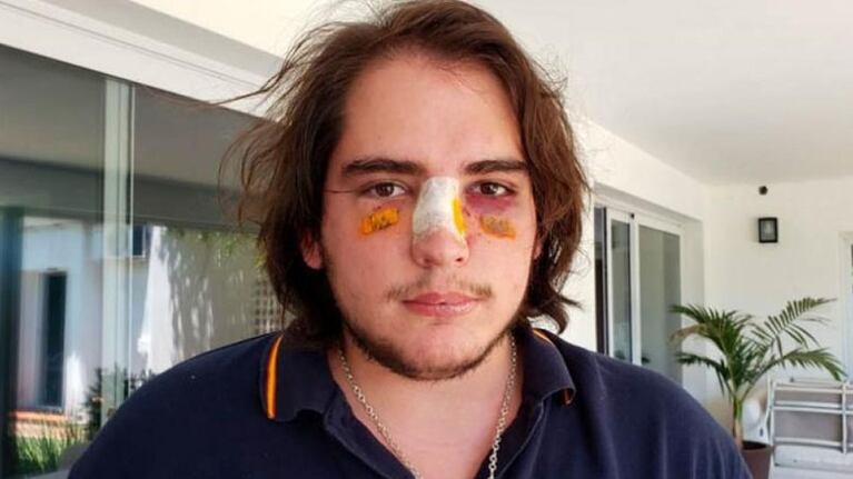 Así quedó el rostro de Lautaro Insúa tras la pelea en Lomas de la Carolina.