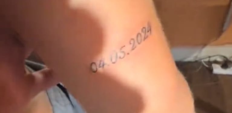 Así quedó el tatuaje de la joven.