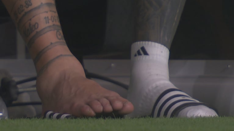 Así quedó el tobillo de Lionel Messi en la final de la Copa América ante Colombia (Foto: captura TyC Sports)