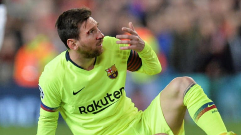 Así quedó la cara de Messi. El árbitro no cobró nada. Foto: EFE. 