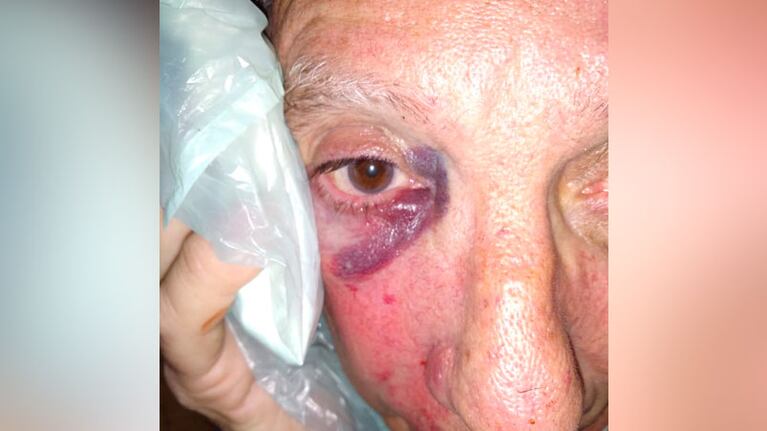 Así quedó la cara del hombre tras la golpiza.