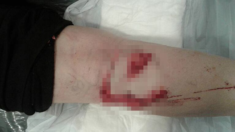Así quedó la rodilla de la mujer herida.