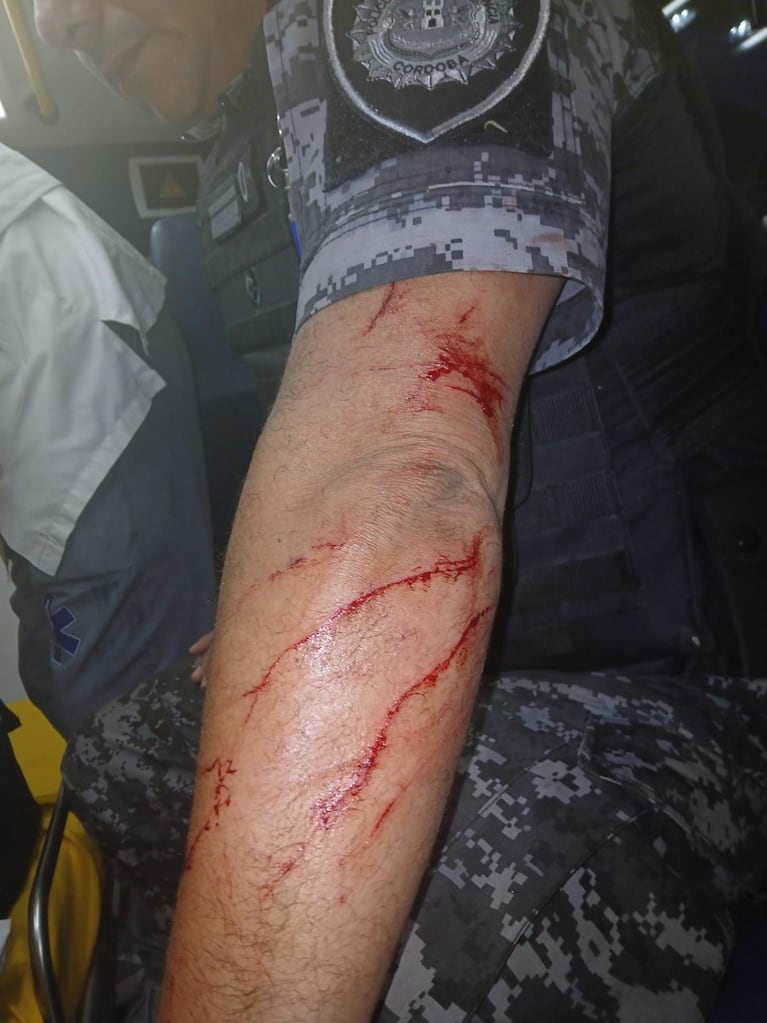 Así terminó un policía que intervino en el operativo.