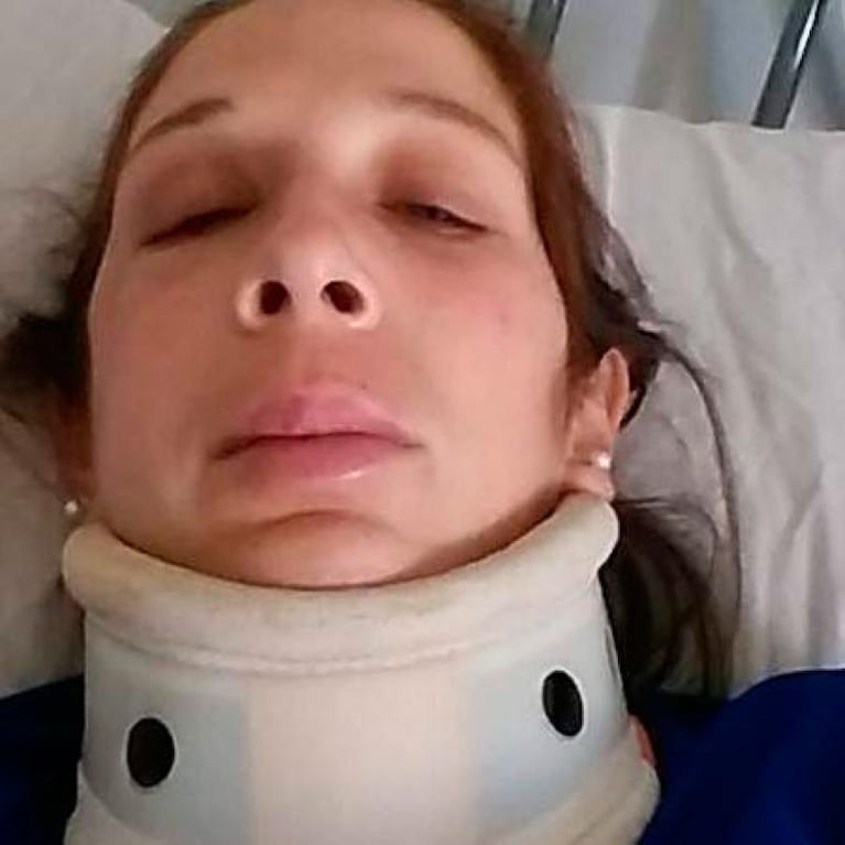 Ataque brutal: su ex pareja le dejó graves secuelas en el rostro
