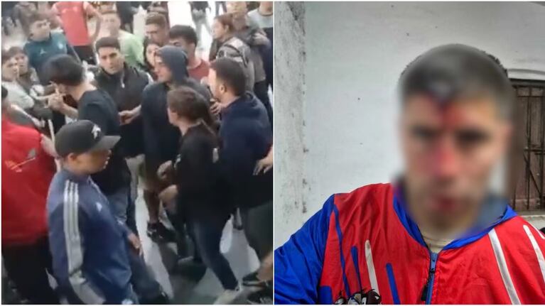 Ataque en un partido de fútbol.