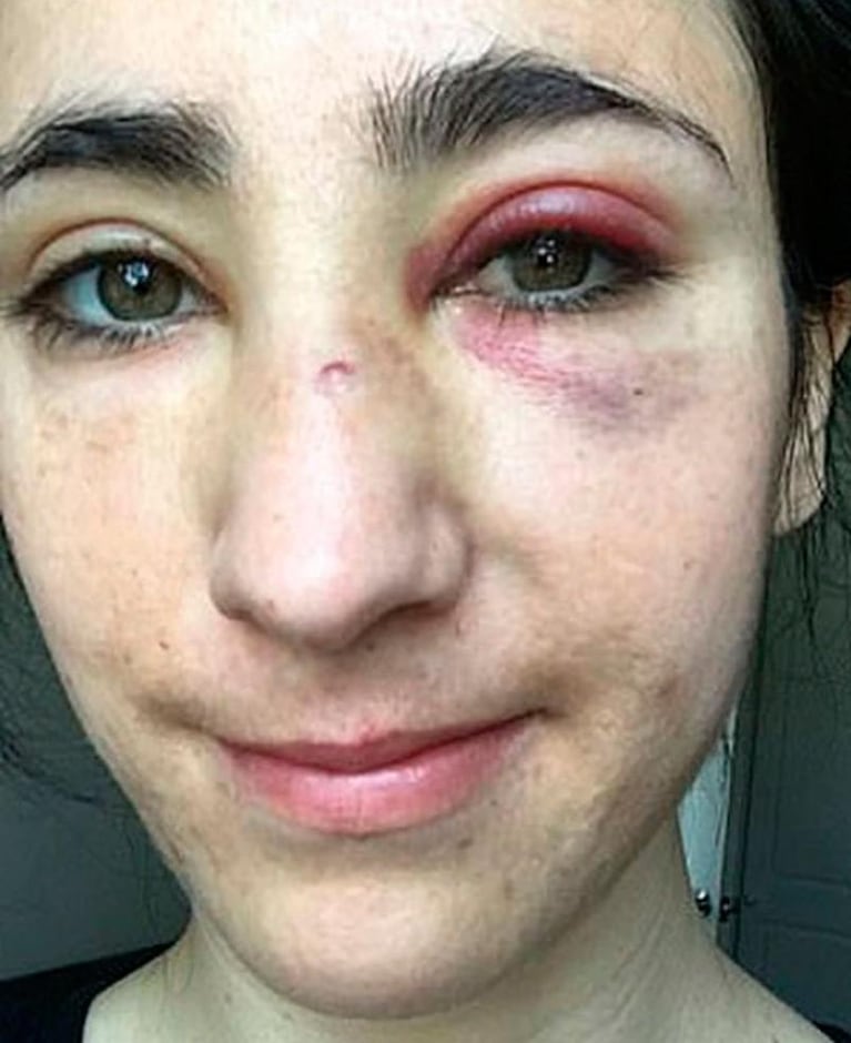 Ataque homofóbico: golpearon a dos mujeres al obligarlas a besarse