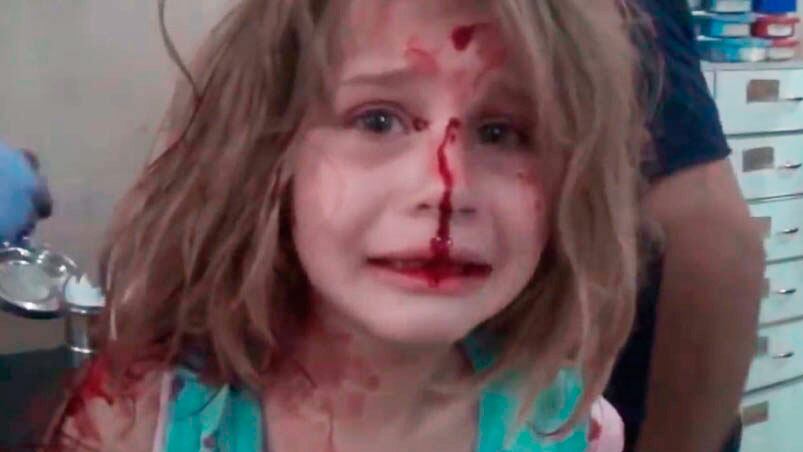 Aya, la nena siria rescatada tras el atentado.