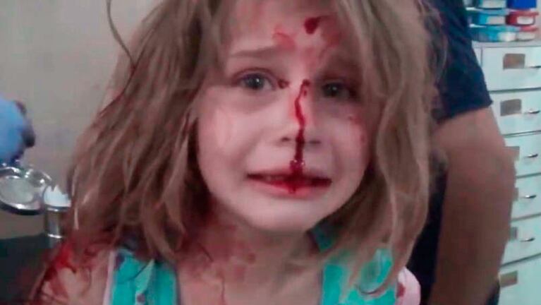 Aya, la nena siria rescatada tras el atentado.