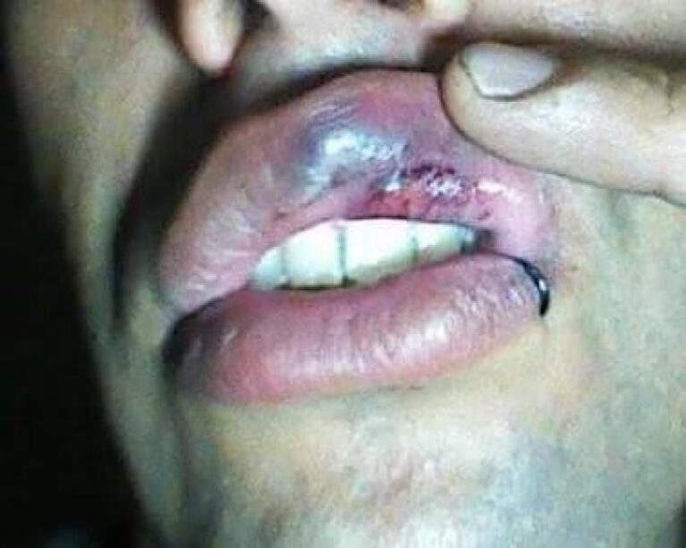 Baile de la Mona: la denuncia de una cordobesa agredida en Catamarca