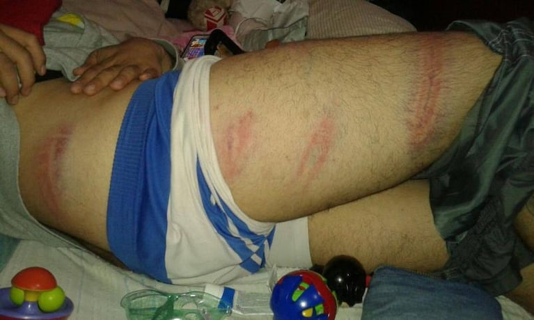 Baile de la Mona: la denuncia de una cordobesa agredida en Catamarca