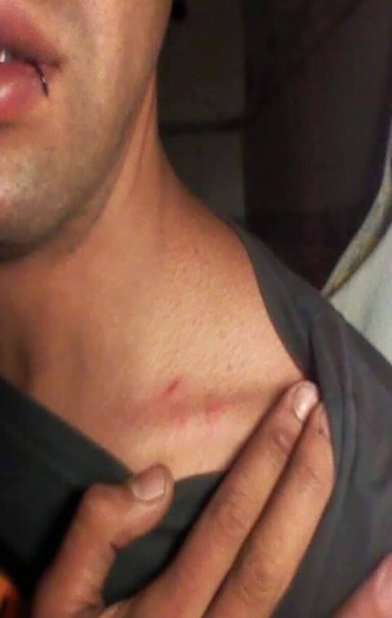 Baile de la Mona: la denuncia de una cordobesa agredida en Catamarca
