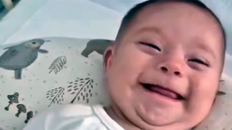 Baltazar tiene tres meses y fue operado del corazón.