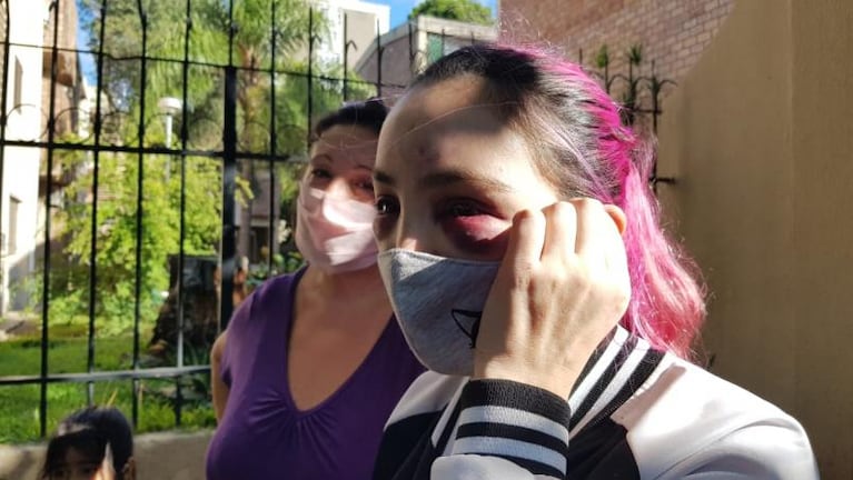 Barrio Pueyrredón: denuncia que quisieron secuestrarla, se resistió y la arrastraron con el auto