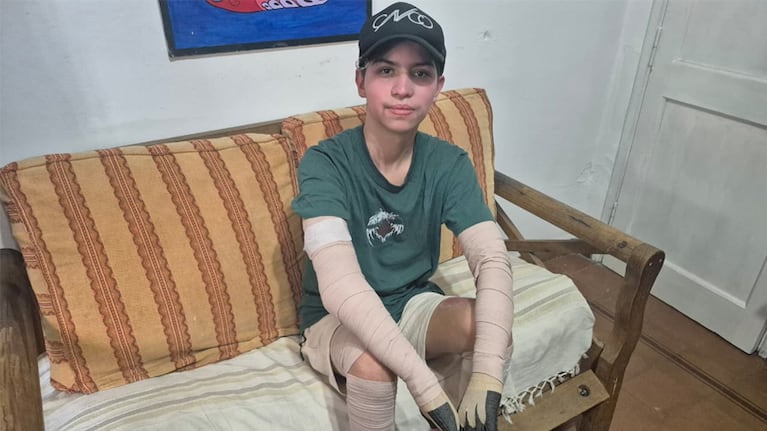 Benjamín se recupera del accidente que le cambió la vida.