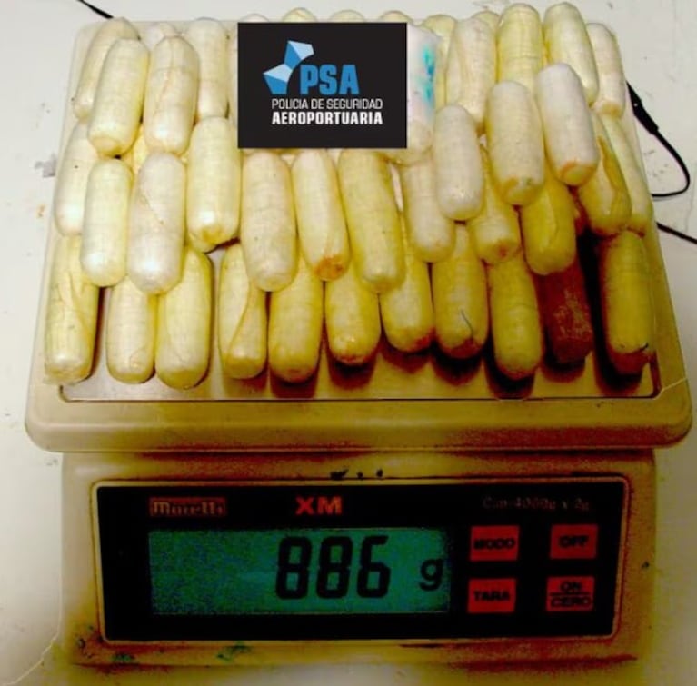 “Bomba de tiempo”: tenía 90 cápsulas de cocaína en el estómago que quería traficar a Europa