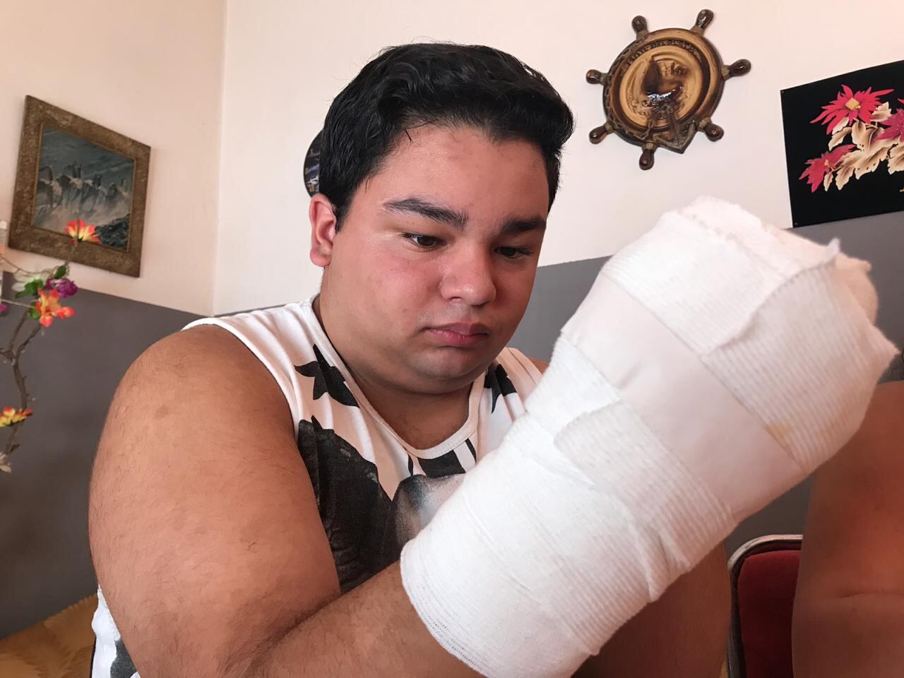 Brian perdió la mano en una picadora de carne.
