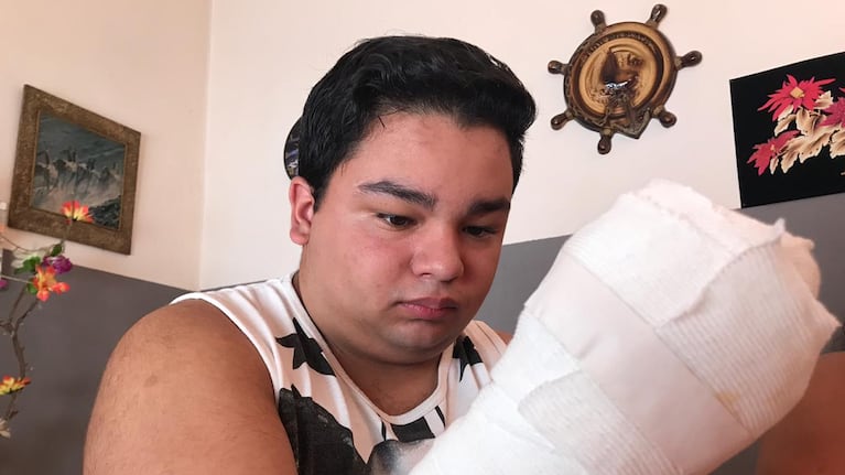 Brian perdió la mano en una picadora de carne.