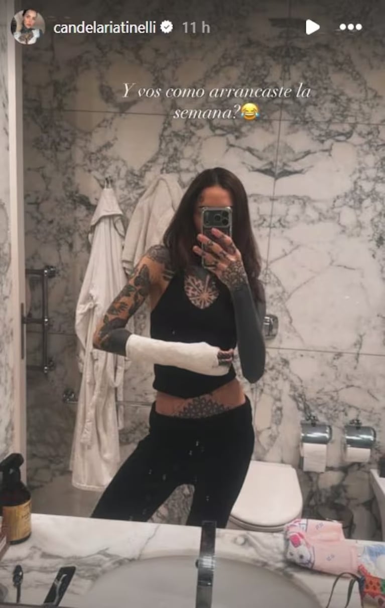 Cande Tinelli sufrió un duro accidente y tuvo que ser operada de urgencia: la foto