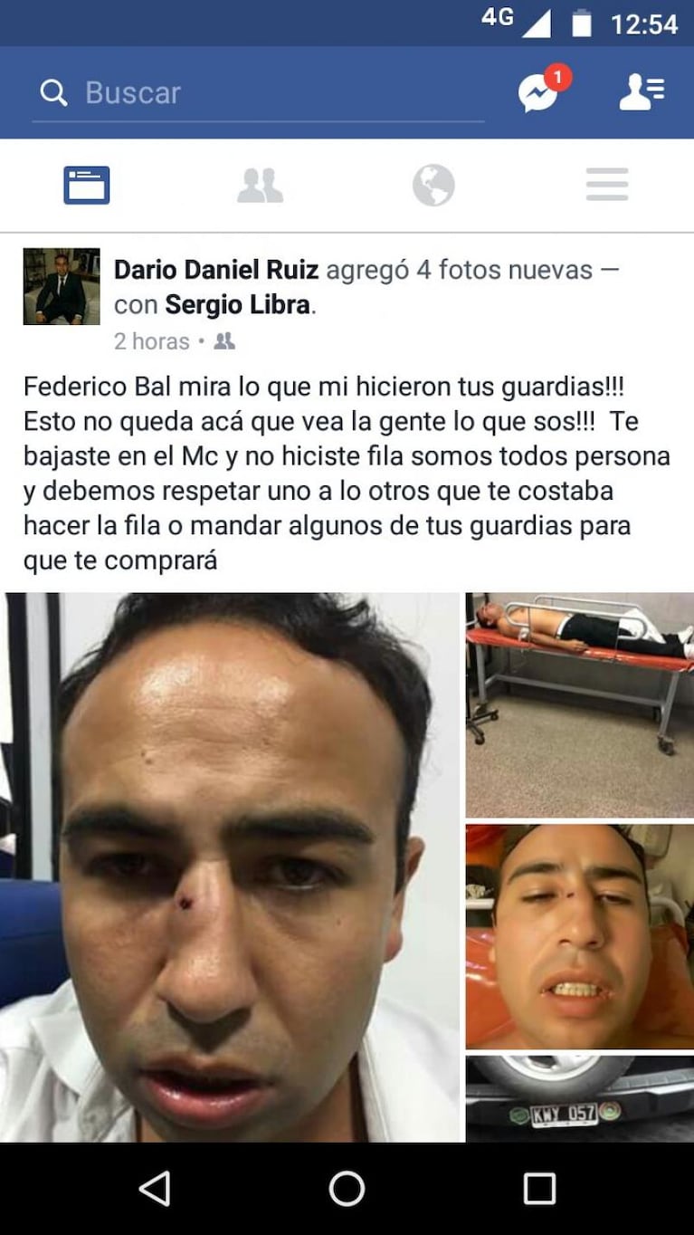Carlos Paz: denunciaron a los guardaespaldas de Fede Bal  