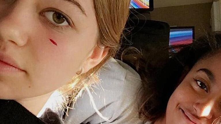 Casa Blanca: la mascota de Obama atacó a un joven