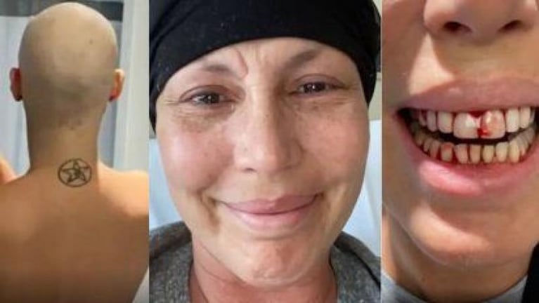 Celina Rucci reveló que tuvo leucemia y mostró las impactantes imágenes del tratamiento