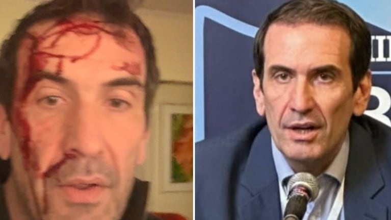 Cervi denunció el hecho y recibió mensajes de apoyo de políticos de todo el país.
