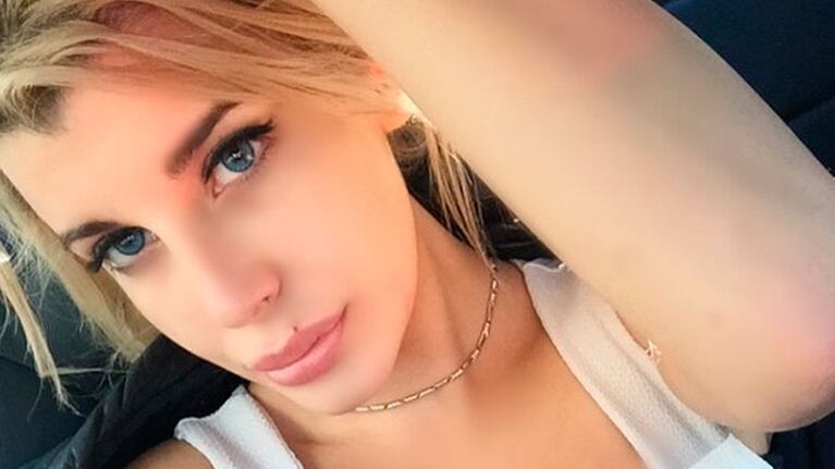 Charlotte Caniggia se puso más colágeno en la boca.