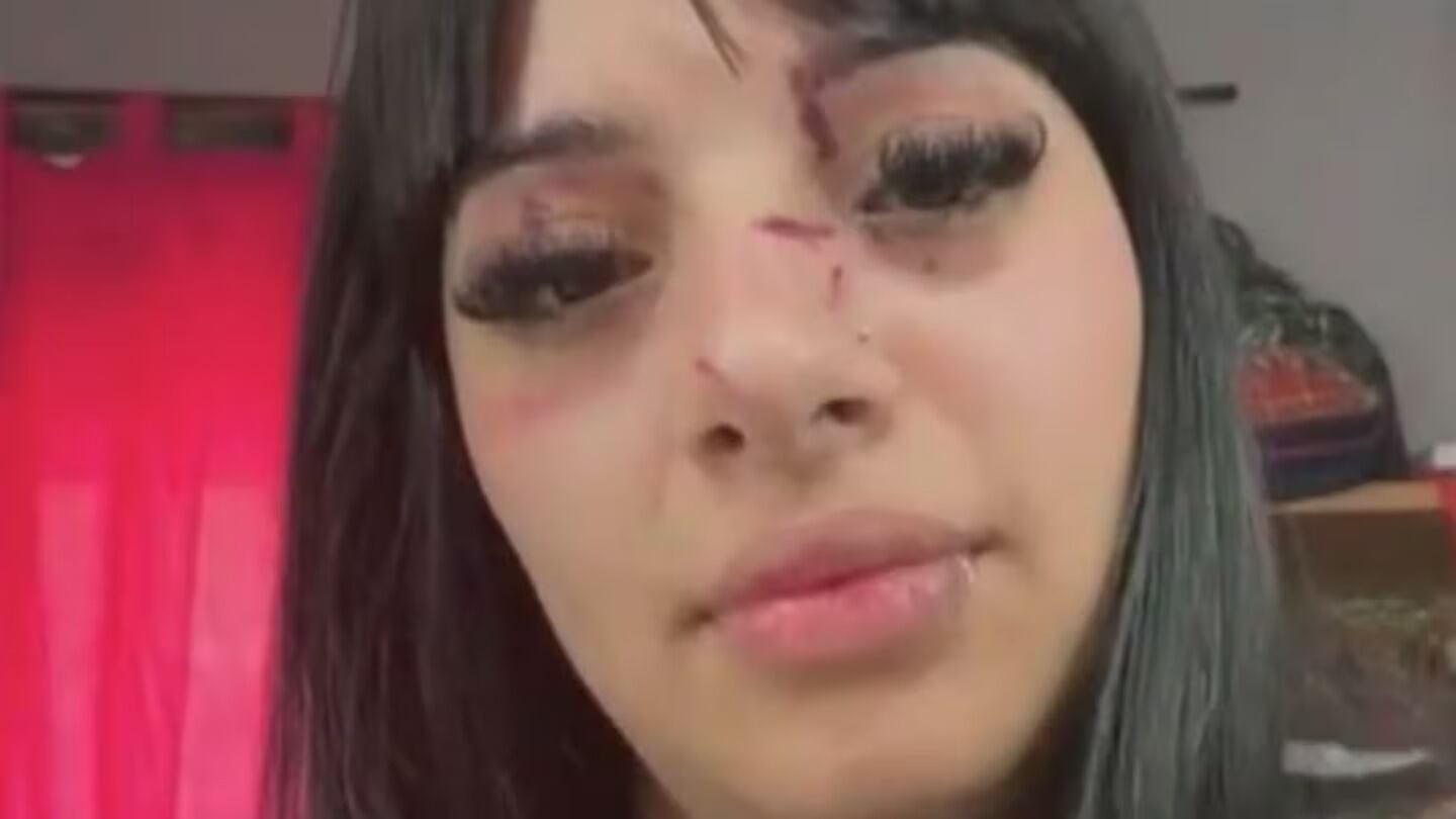 Chica golpeada por linda.